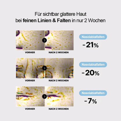 Maison's straffende Hydrogel Augenpads